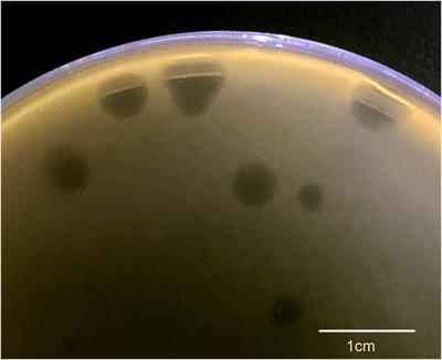 Whole-genome sequencing, annotation, and biological characterization of a novel Siphoviridae phage against multi-drug resistant Propionibacterium acne